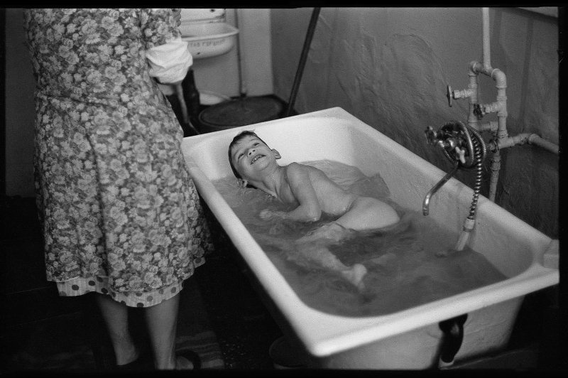 В ванной. Ортопедический детский санаторий №7, 21 декабря 1988, г. Новокузнецк. Выставка «Больничная жизнь» с этой фотографией.