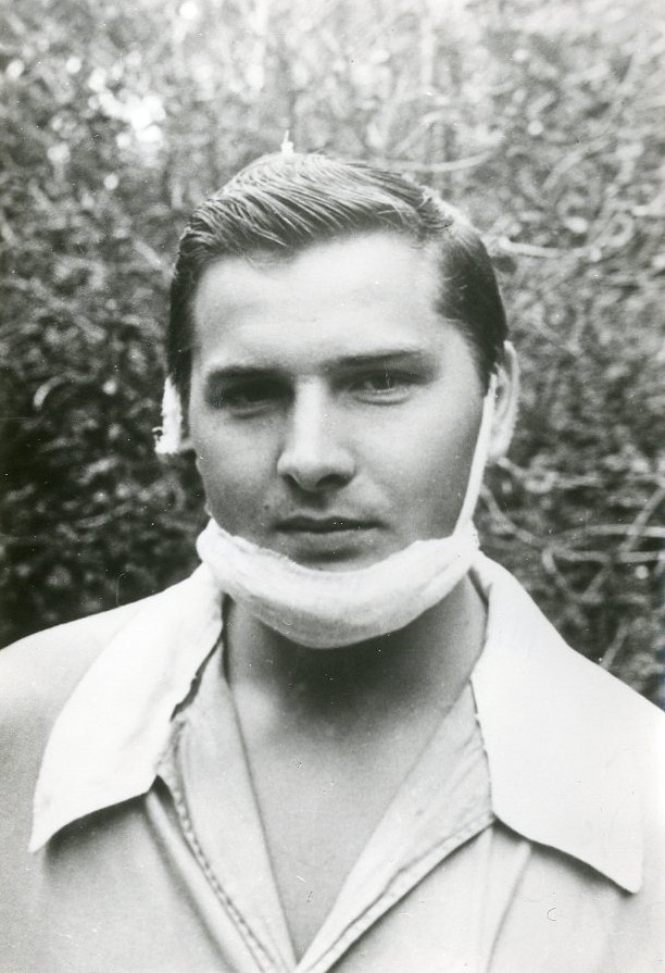 Николай Кравченко, 1977 год. Баптист-инициативник, отказавшийся принять воинскую присягу. После лечения в госпиталях был комиссован. Вылечить поврежденные при избиении челюсти ему не удалось.