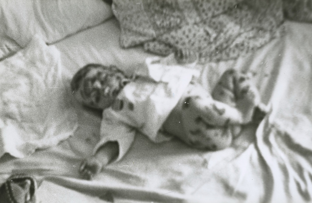 На кровати с ветрянкой, 1987 год, г. Москва. Татьяна Юрьевна Левченко.