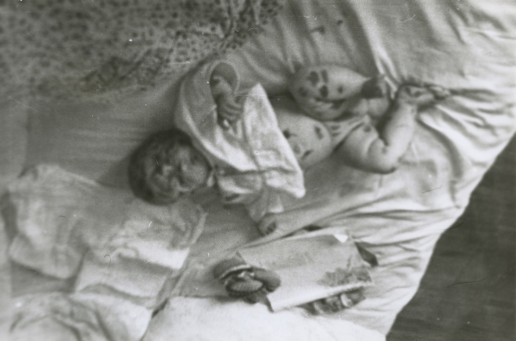 На кровати с ветрянкой. Ракурсы, 1987 год, г. Москва. Татьяна Юрьевна Левченко.