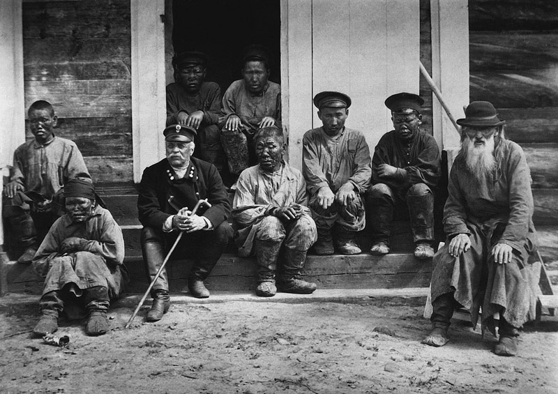 В Вилюйской колонии прокаженных, 1910-е, г. Вилюйск